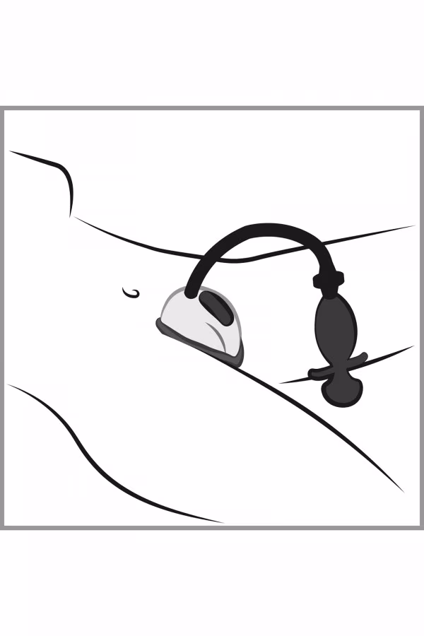 Ventouse vaginale vibrante avec télécommande pas chère