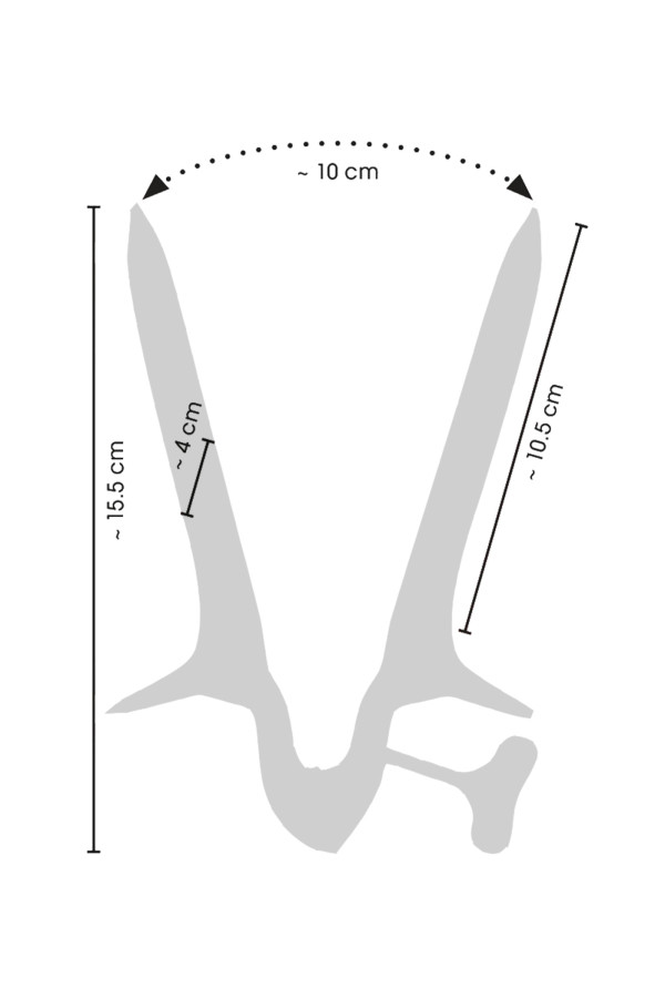 Spéculum vaginal en acier inoxydable