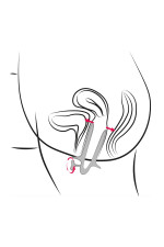 Spéculum vaginal en acier inoxydable