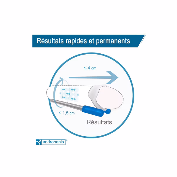 Extenseur de pénis Andropenis PRO - Pompe à Pénis